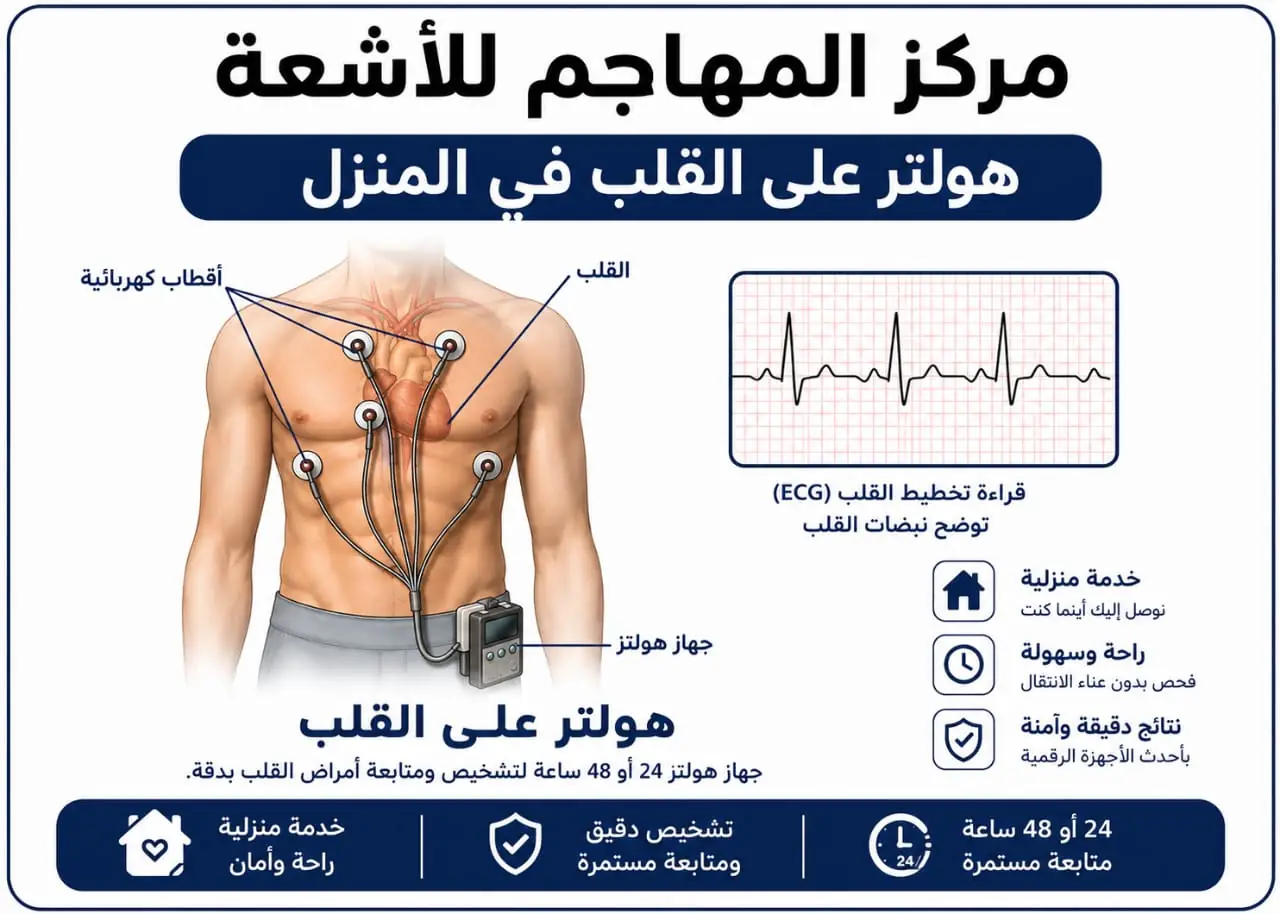 هولتر نبضات القلب